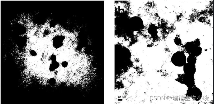 Preparation of tacrolimus loaded HSA protein nanoparticles / dct-bsa docetaxel albumin nanoparticles / serum albumin hyaluronic acid nanoparticles